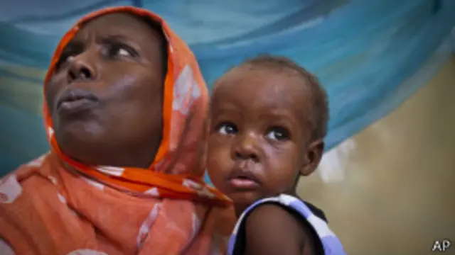 Niño con sarampión en Somalia