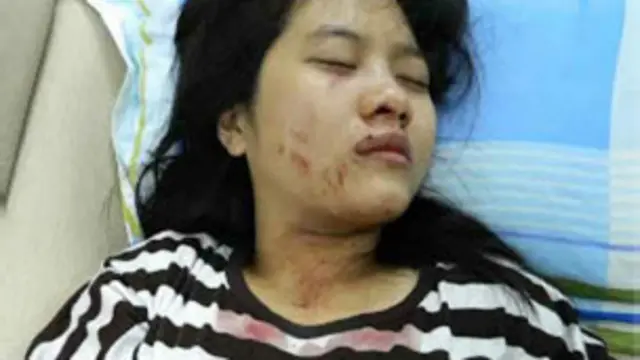 Nguyễn Hoàng Vi cáo buộc công an đã đánh em gái và mẹ