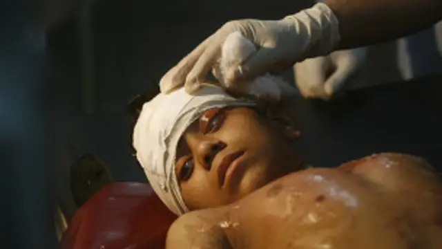 ان حملوں میں بچوں اور خواتین کی بڑی تعداد ہلاک اور زخمی ہوئی ہے