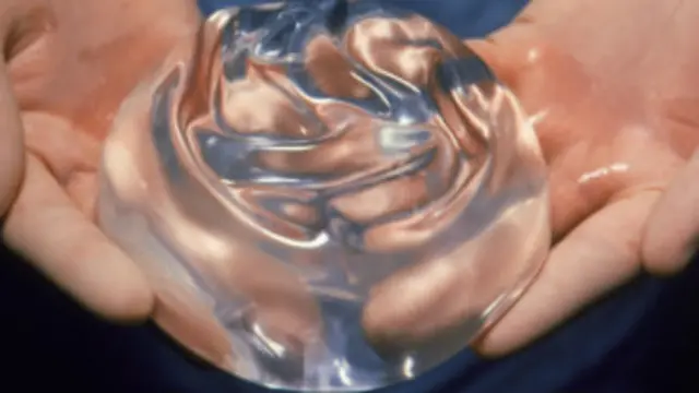 कॉस्मेटिक स्तन पर शिखा के मन में संदेह था कि ये उनके पति के बीच दूरियां पैदा करेगा, पर उन्होंने बहुत साथ दिया.