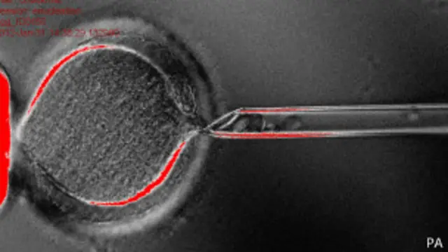 Получение стволовых клеток