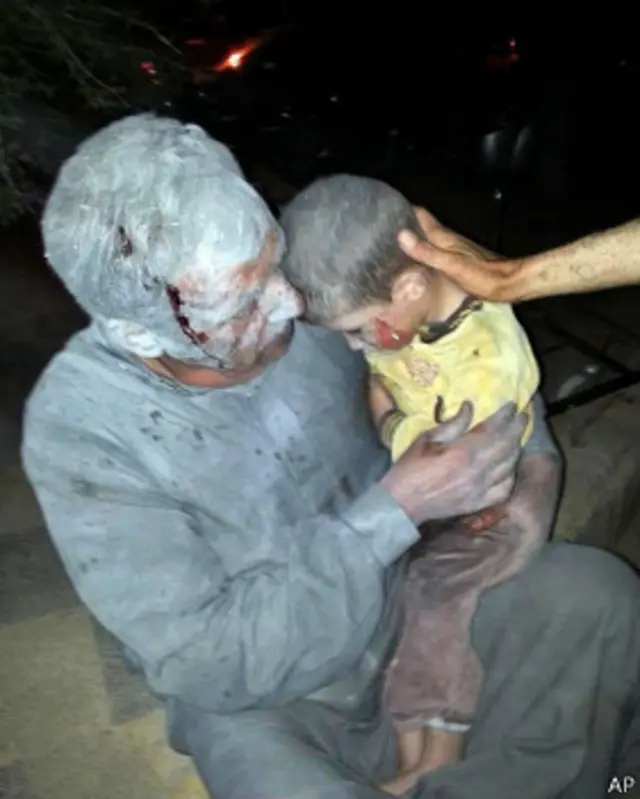 تصویر مردی از اهالی سراقب و پسرش 'پس از حمله شیمیایی'