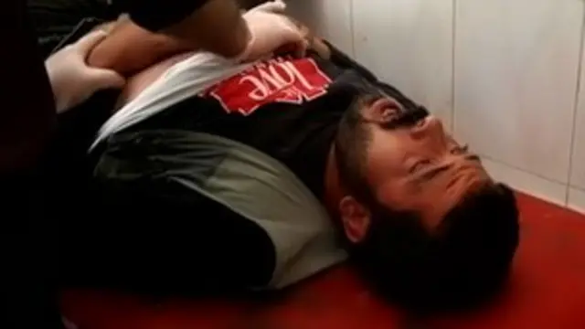 मोहम्मद खातिब का कहना है कि उस पर हमले का बुरा असर हुआ है