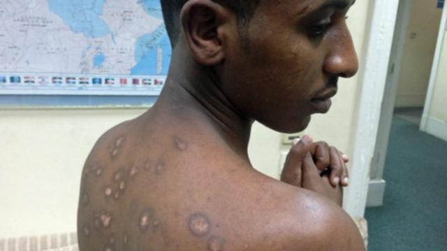 'Me batem com paus, me queimam com fogo e eletricidade', disse Semereseleção panamenha de futebolnovembro