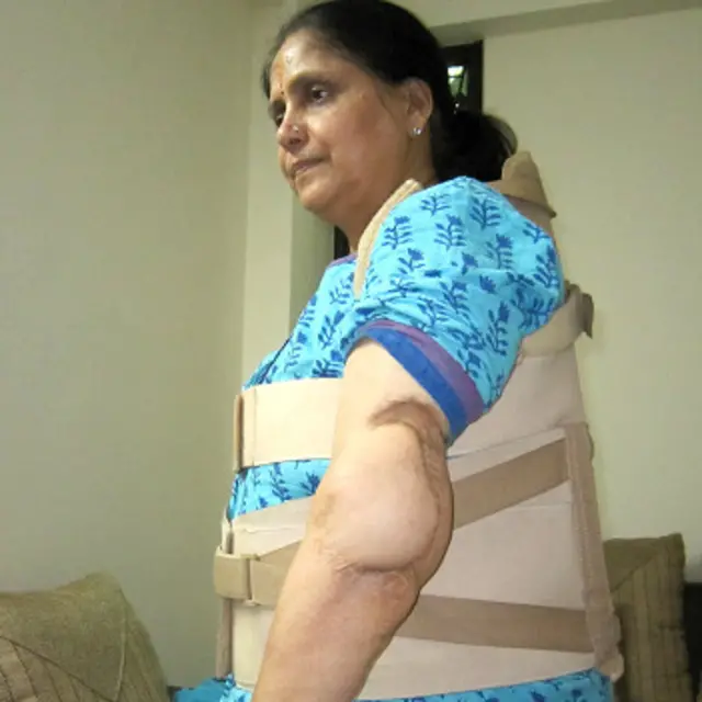 संपत्ति के साथ दो बार स्पीड ब्रेकरों के कारण बड़ी दुर्घटनाएं हुई