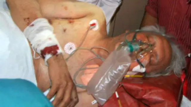 नक्सली हमले के शिकार बने विद्या चरण शुक्ल