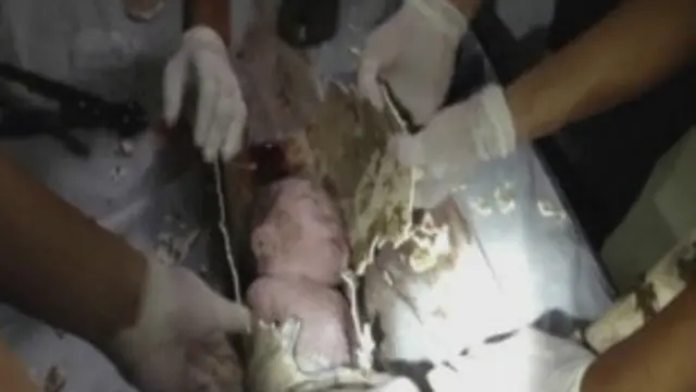 Bebê teve de ser levado para hospital dentro de cano (Reuters)