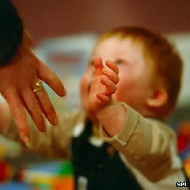 Ребенок, страдающий синдромом Дауна