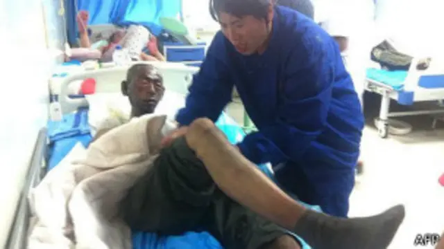 Выживший в пожаре на птицефабрике в Китае