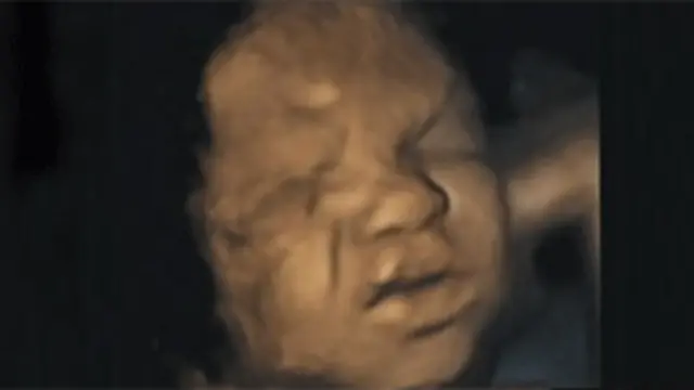  ’حمل کے دوران جنین مسکرانے ، بھنویں کونیچھے کرنے اور ناک میں جْریاں لانے کے حرکات کرتا ہے‘