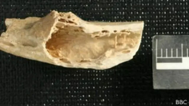 Пораженная раком кость неандертальца