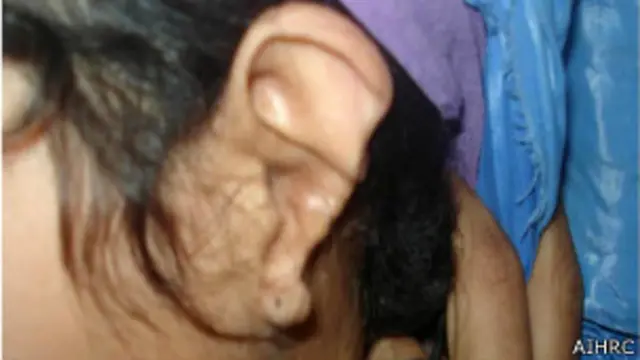 ځينې افغان ښځې په زور ودونو څخه د خلاصون په موخه اړ وځې چې ځانونو ته اور واچوي