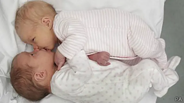 Altura, masa corporal, edad y hasta las estaciones del año pueden influir en la concepción de mellizos.