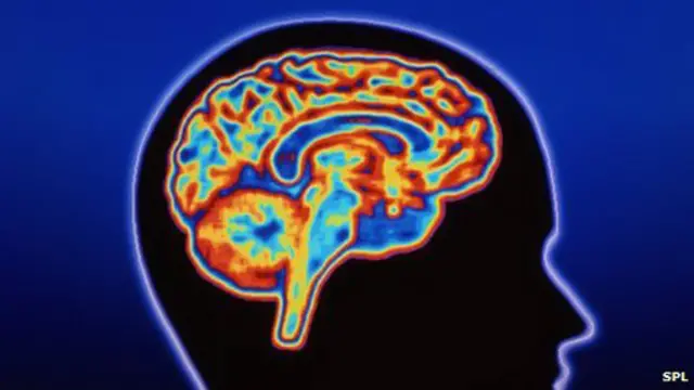 Gráfico de actividad cerebral