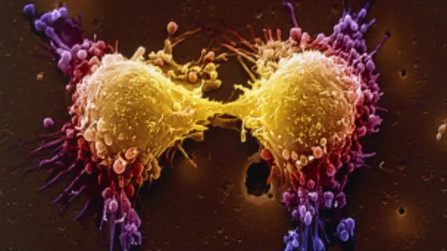कैंसर के इलाज का नया तरीका