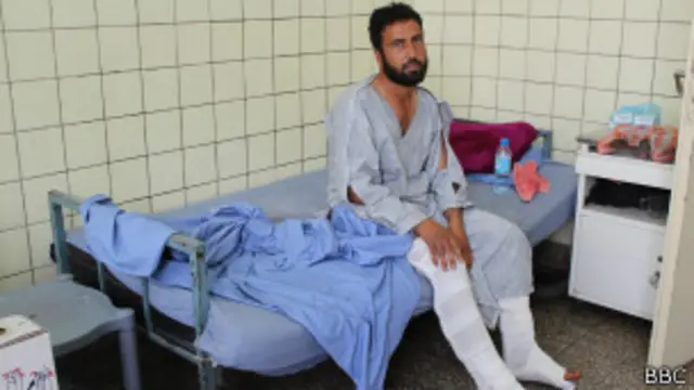 شفیع الله یکی از دست فروشان کابل در انفجار اخیر زخمی شد