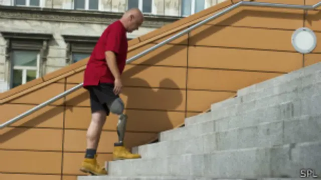 Hombre subiendo escalera con prótesis