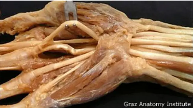 Detalle de un cuerpo preservado con el método de Thiel 