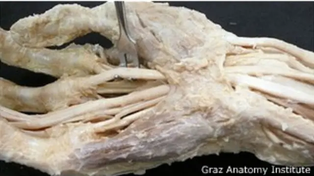 Detalle de una mano preservada con formaldehído. 