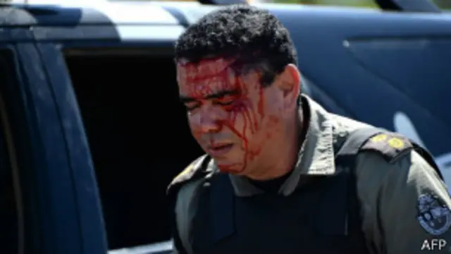 Policial ferido | Foto: AFP