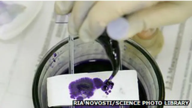 مضادات حيوية