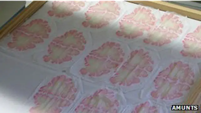 Impresión de escáneres de capas del cerebro