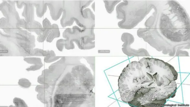 Los investigadores tardaron 10 años en reconstruir el cerebro en 3D. 