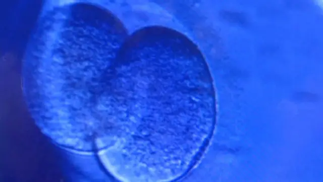 आईवीएफ के नफे-नुकसान को लेकर शुरू से बहस होती रही है.