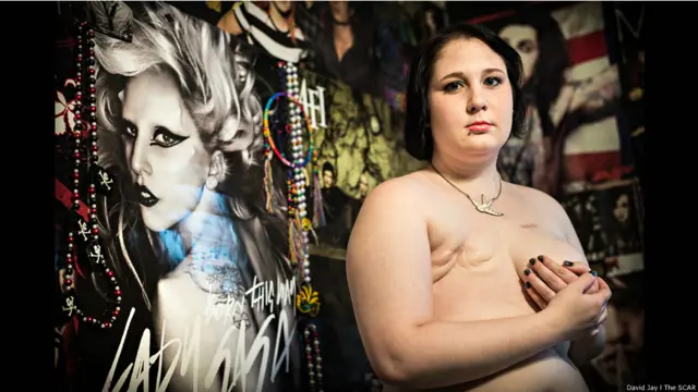 Leah © David Jay/The SCAR Project