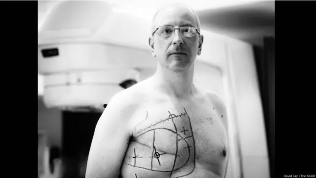 Oliver © David Jay/The SCAR Project