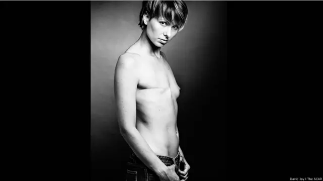 Paulina © David Jay/The SCAR Project