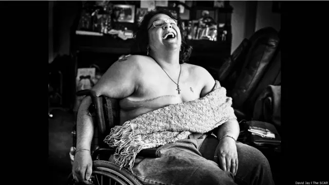 Sara © David Jay/The SCAR Project