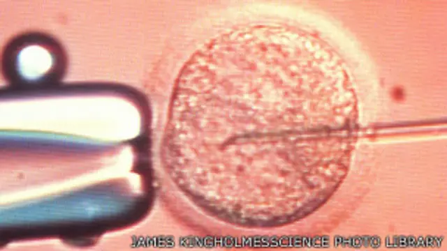 искусственное оплодотворение под микроскопом