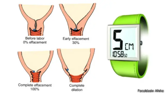 Invenção israelense substitui ginecologista por smartphone / Departamento de Engenharia Médica da Faculdade Afeka