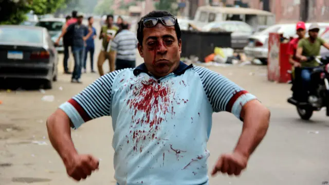 یکی از مجروحان در خیابانهای اطراف دانشگاه قاهره