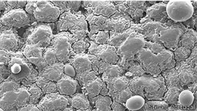 Aspecto al microscopio de la superficie de un huevo de arao común