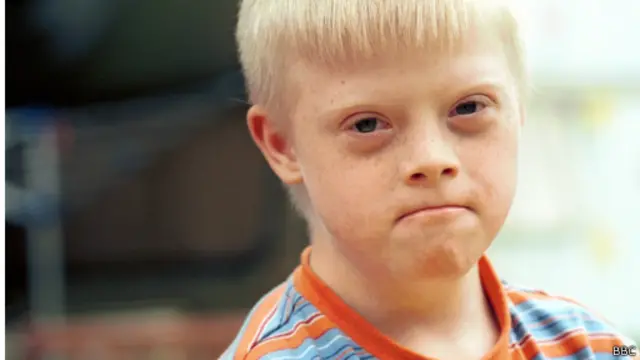 Garoto com síndrome de Down (crédito: BBC)
