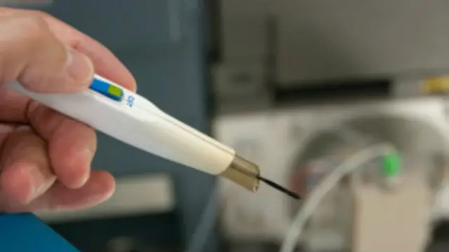 اس آلے کو لندن کے تین ہسپتالوں میں آزمایا جا رہا ہے