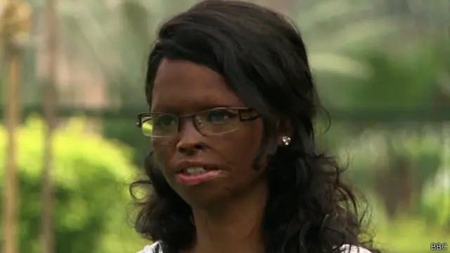 एसिड अटैक की शिकार लक्ष्मी को लगता है कि दोषियों को सजा भी सख़्त से सख़्त दी जाए