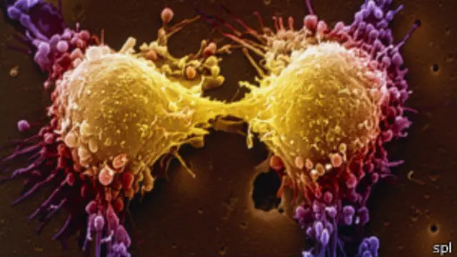 कैंसर का जोखिम गुणसूत्रों, जीवन शैली और माहौल पर निर्भर करता है.