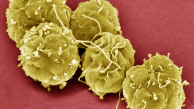 سٹیم سیل جسم کے کسی بھی خلیے میں ڈھل سکتے ہیں