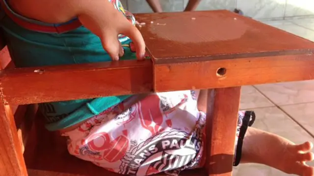 थैलिडोमाइड से पीड़ित एलन