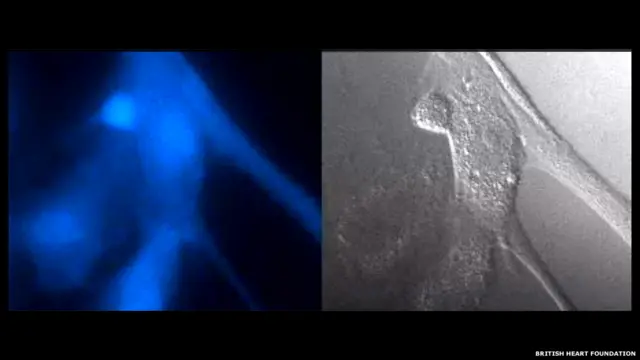 मुलायम मांसपेशियाँ मृत रक्त नलिकाओं में मरी हुई कोशिकाओं को हटाने में मदद करती हुईं.