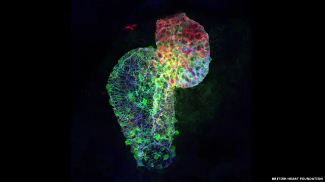 दो दिन की उम्र वाली जेबरा नस्ल की मछली.