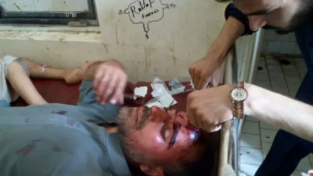 پندرہ جون کو کوئٹہ میں ایک بس دھماکے میں 14 طلبہ  ہلاک ہوئے۔ بعد میں شدت پسند اس ہسپتال گئے جہاں زخمیوں کو لے جایا گیا تھا اور دس افراد ہلاک کر دیے۔