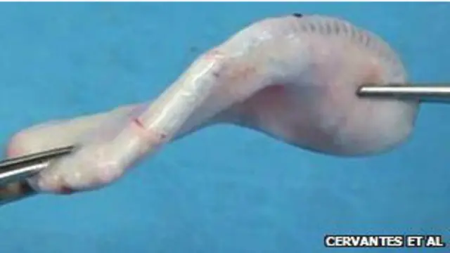 Искусственное ухо