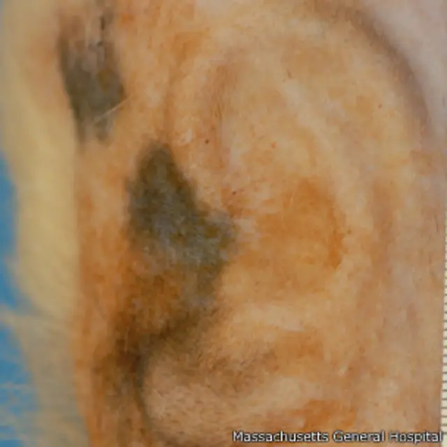 Orelha recriadabrasil apostaslaboratório (Foto: Massachusetts General Hospital)