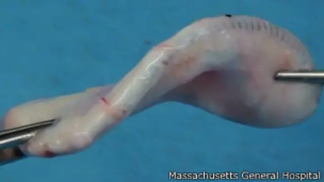 Orelha recriadabrasil apostaslaboratório (Foto: Massachusetts General Hospital)