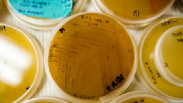 ماہرین کا کہنا ہے کہ عالمی سطح پر نئی نسل کے بیکٹیریا کی دوا پر تحقیق کرنے کی ضرورت ہے