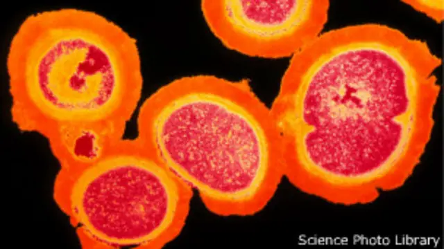 استافیلوکوک طلایی مقاوم به متی‌سیلین یکی از معضلات مراکز درمانی است